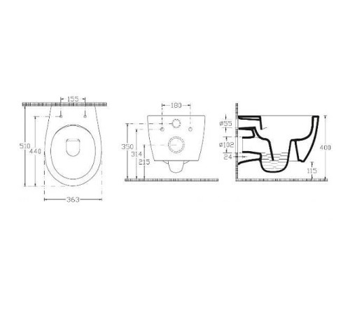Унитаз подвесной безободковый Allen Brau Fantasy с гигиеническим душем 51x36.3 см 4.11HC1.20